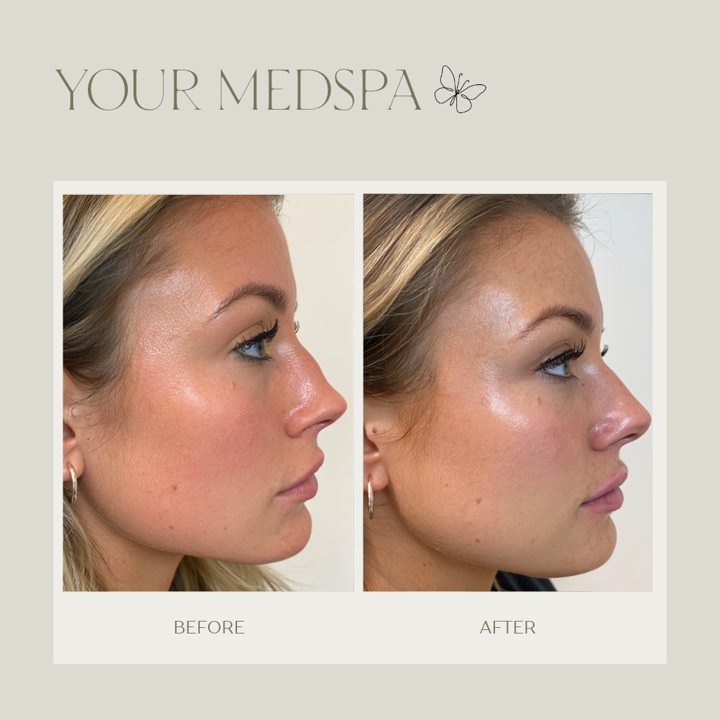 Branded medspa before-and-after post example